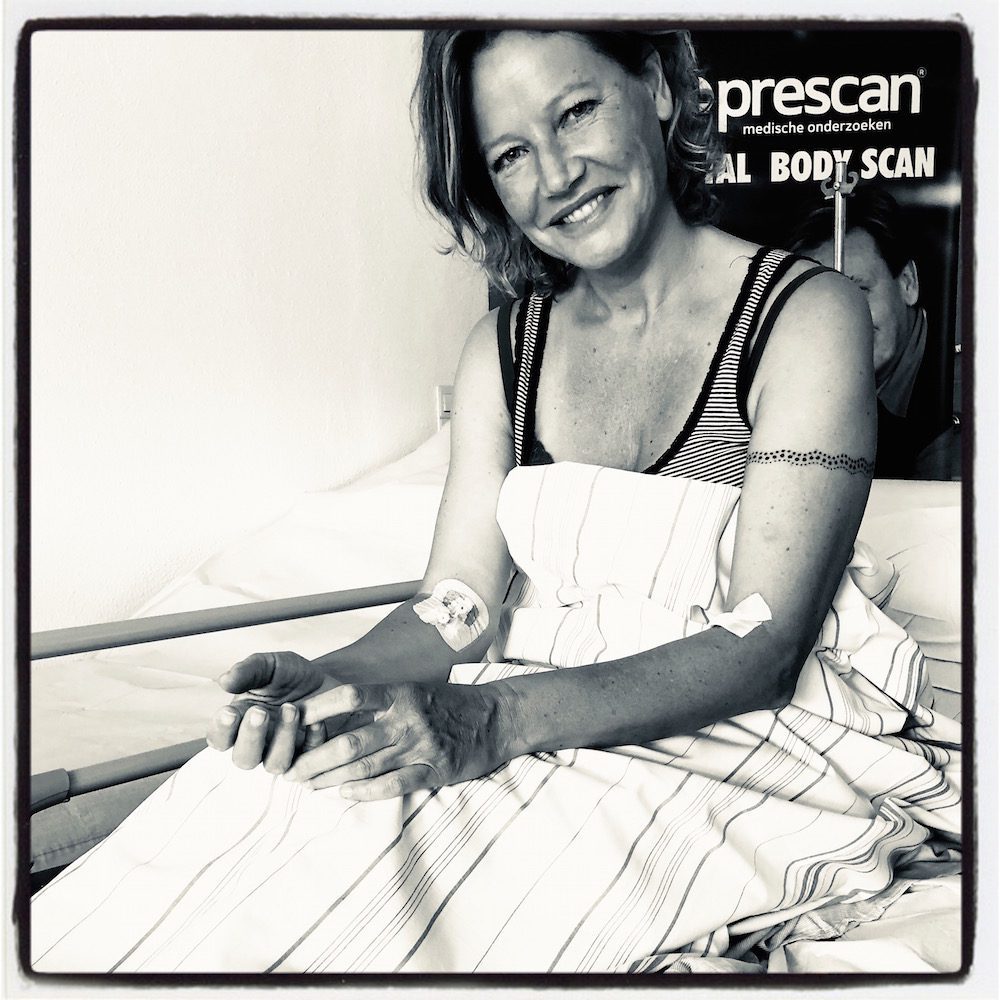 Prescan: useful or just a medical adventure?