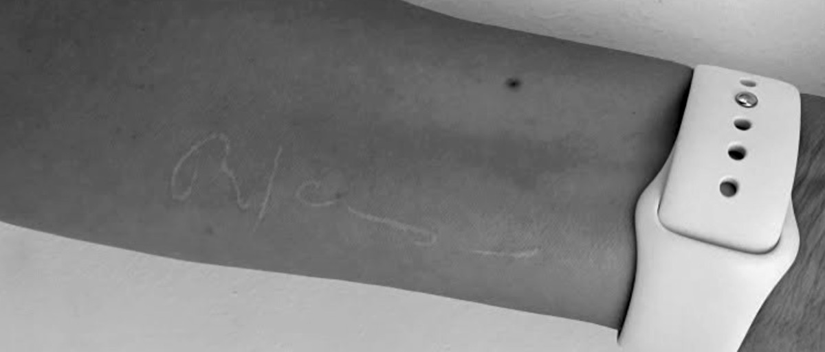 Tattoo of Robert Jacobs’ signature on Esther’s forearm